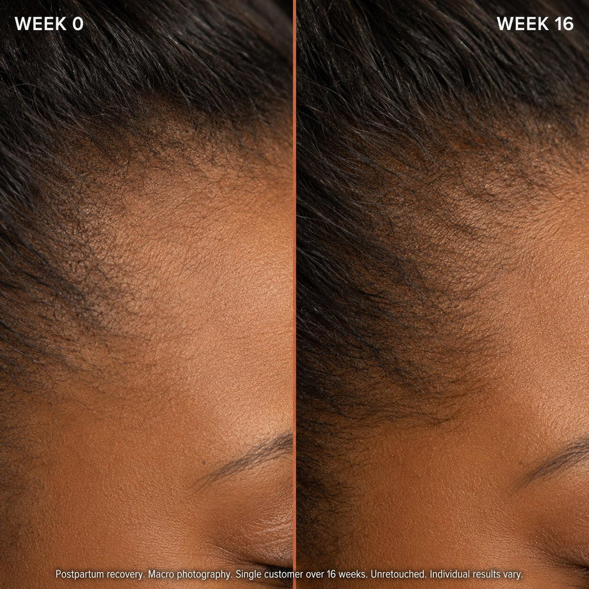 Botanical Hair Elixir